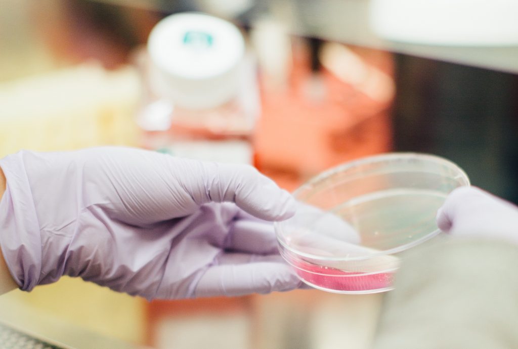 Specimen in a Petri Dish | Breast Cancer Car Donations
