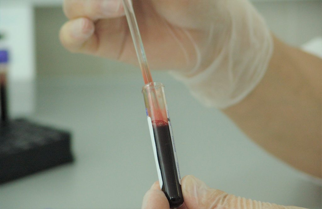 Blood Analysis in a Medical Laboratory | Breast Cancer Car Donations