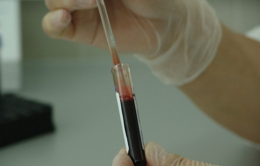 Analyzing Blood in the Laboratory | Breast Cancer Car Donations