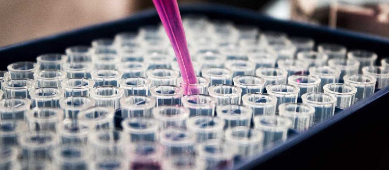 Purple Pipette in the Lab | Breast Cancer Car Donations