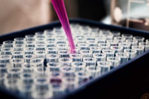 Purple Pipette in the Lab | Breast Cancer Car Donations