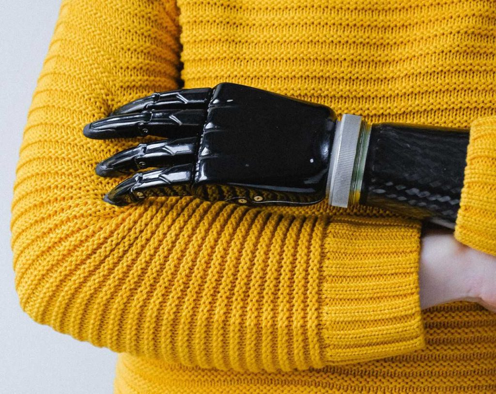 Person With Prosthetic Arms | Breast Cancer Car Donations